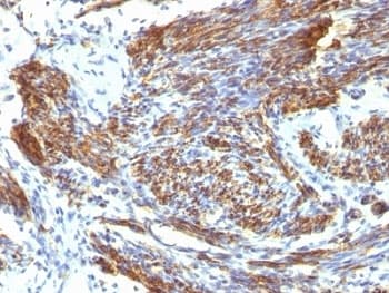 CALD1 / Caldesmon Antibody (clone CALD1/820, Ready-to-Use)