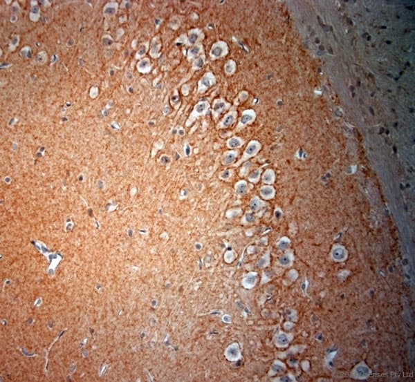 GAD 65+67 Antibody (aa530-600)