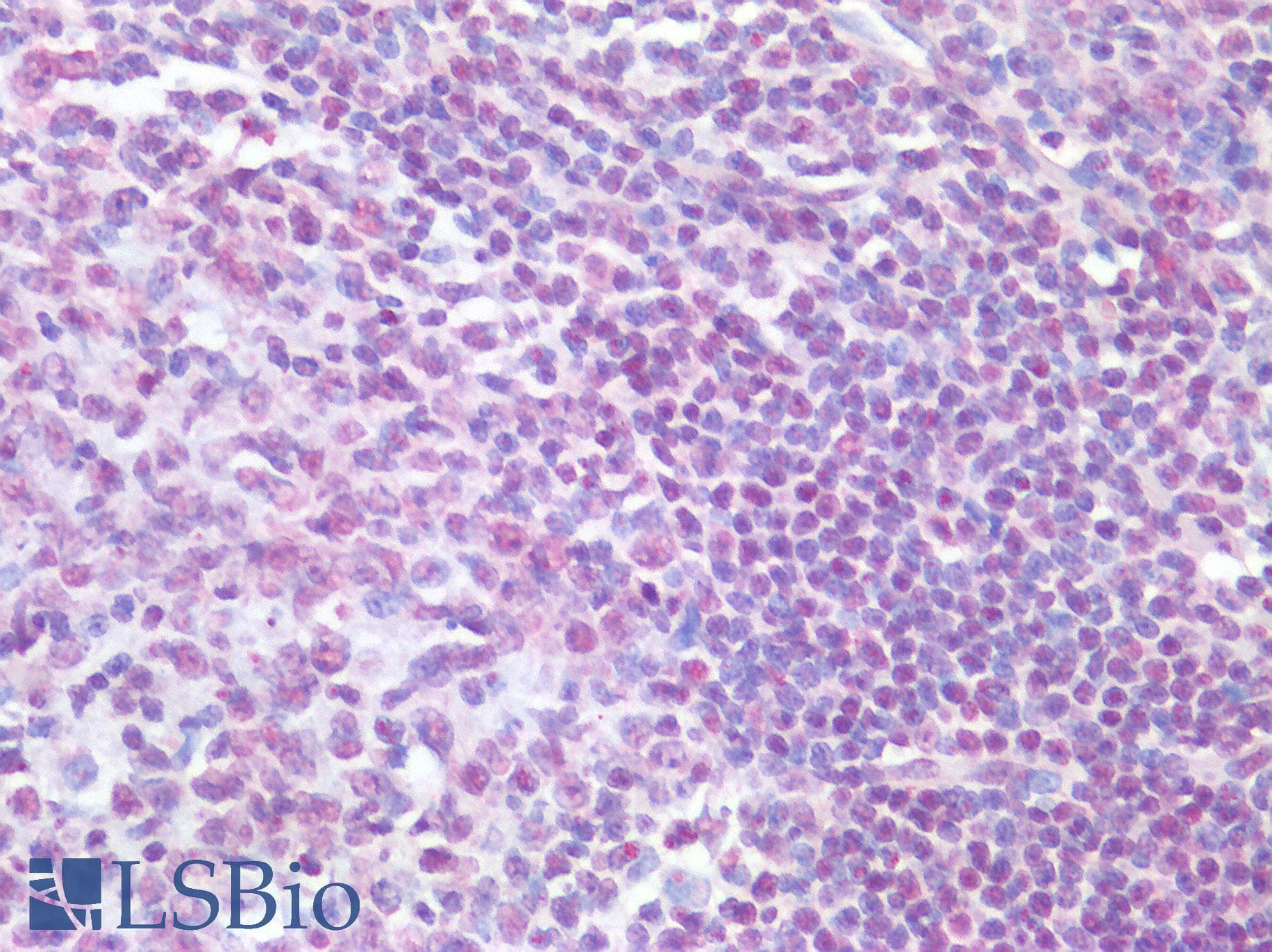 IHC-plus™ Polyclonal Goat anti-Human TICAM1 / TRIF Antibody (IHC)