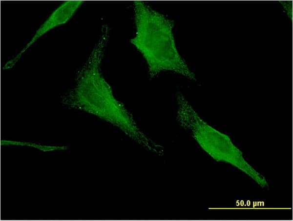 HEXA Antibody (clone 3D1)