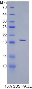 Human ANGPT1 / Angiopoietin-1 Protein (Recombinant His)
