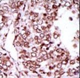 Polyclonal Rabbit anti-Human CAMK2G / CaMK II Gamma Antibody (aa309-338, IHC, WB)