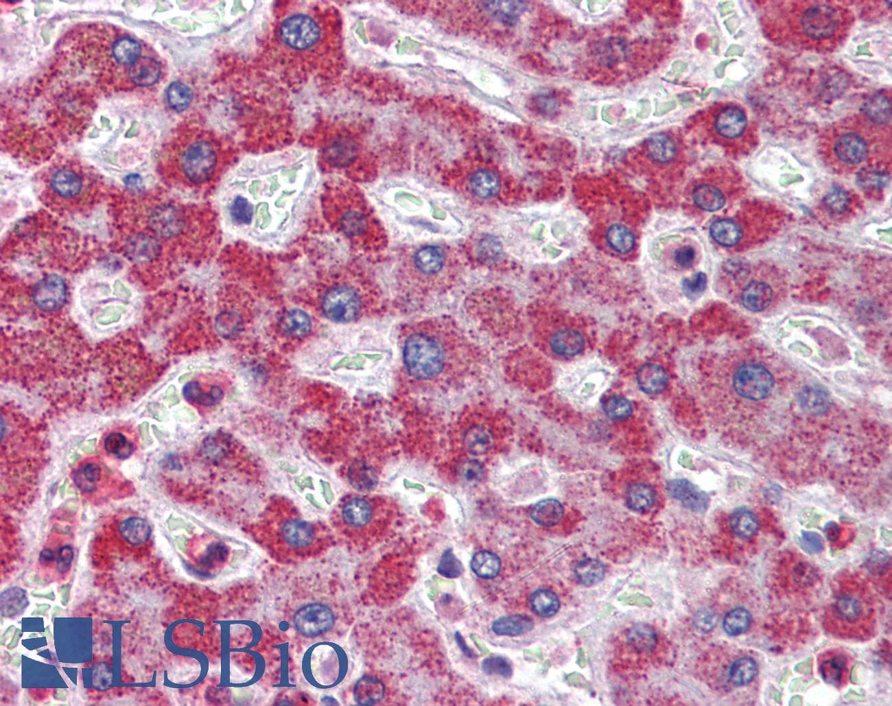 IHC-plus™ ALDH5A1 Antibody