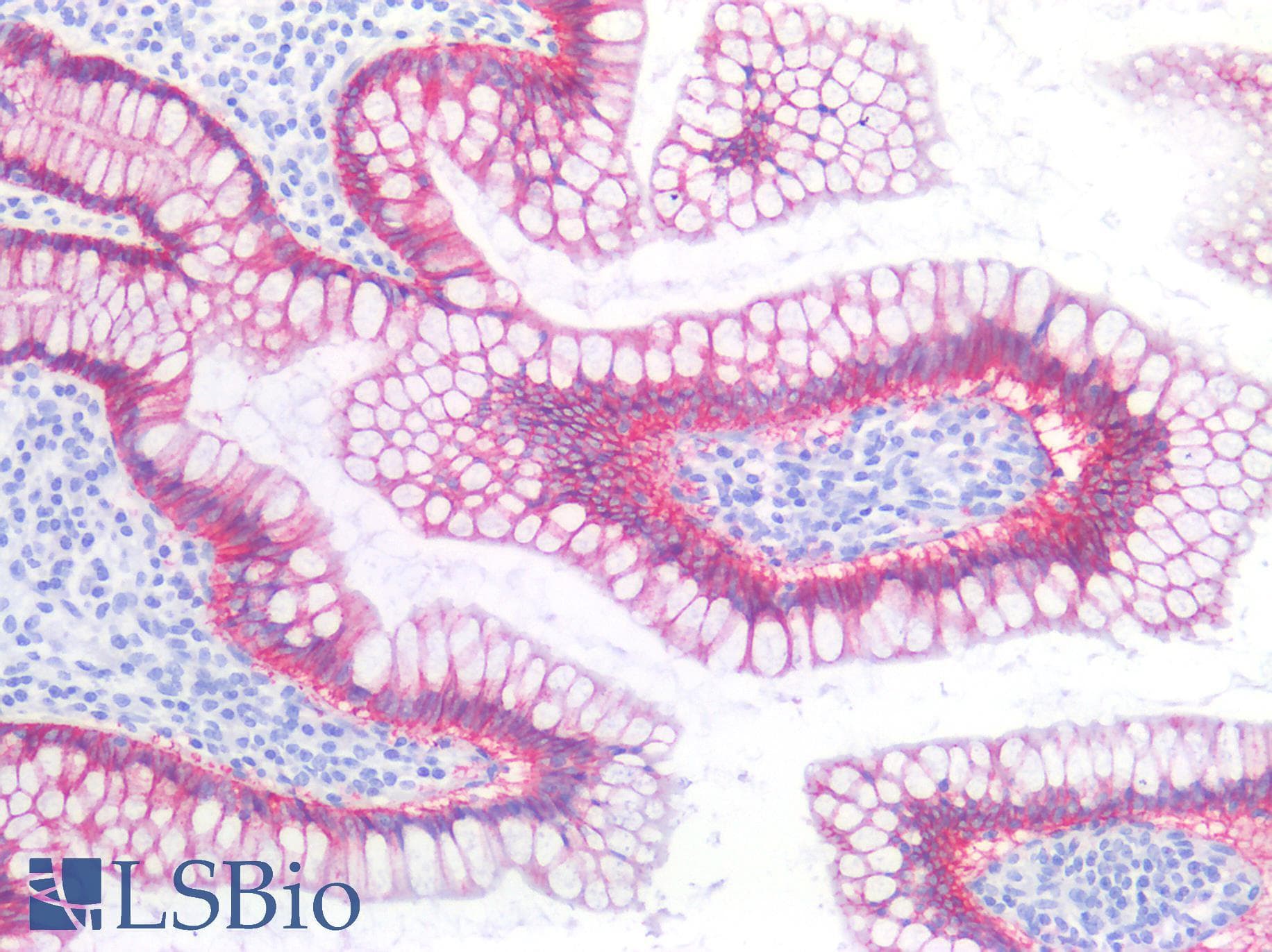 PathPlus™ Monoclonal Mouse anti-Human CLDN3 / Claudin 3 Antibody (clone ABT-CLD3, IHC, WB)