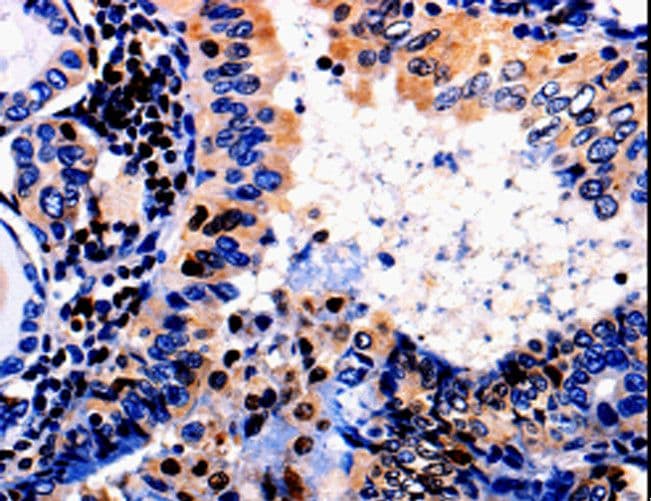 Polyclonal Rabbit anti-Human ALOX5 / 5-LOX Antibody (IHC)