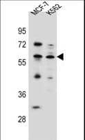 Polyclonal Rabbit anti-Human KLF4 Antibody (aa283-314, WB)