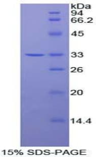 Human PDPK1 / PDK1 Protein (Recombinant His-T7)