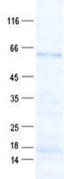 Human USP22 Protein (Recombinant His, N-Terminal)