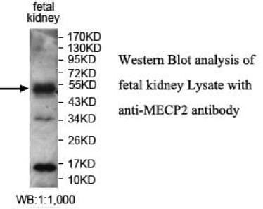 MECP2 Antibody (aa2-211)