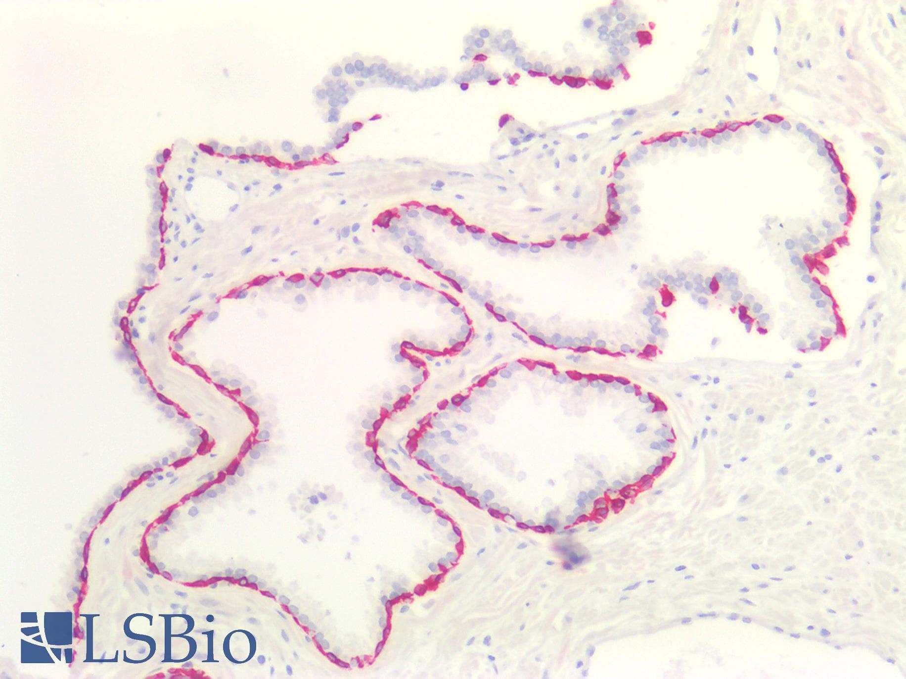 IHC-plus™ Monoclonal Mouse anti-Human KRT5 / CK5 / Cytokeratin 5 Antibody (clone OTI1C7, IHC, WB)