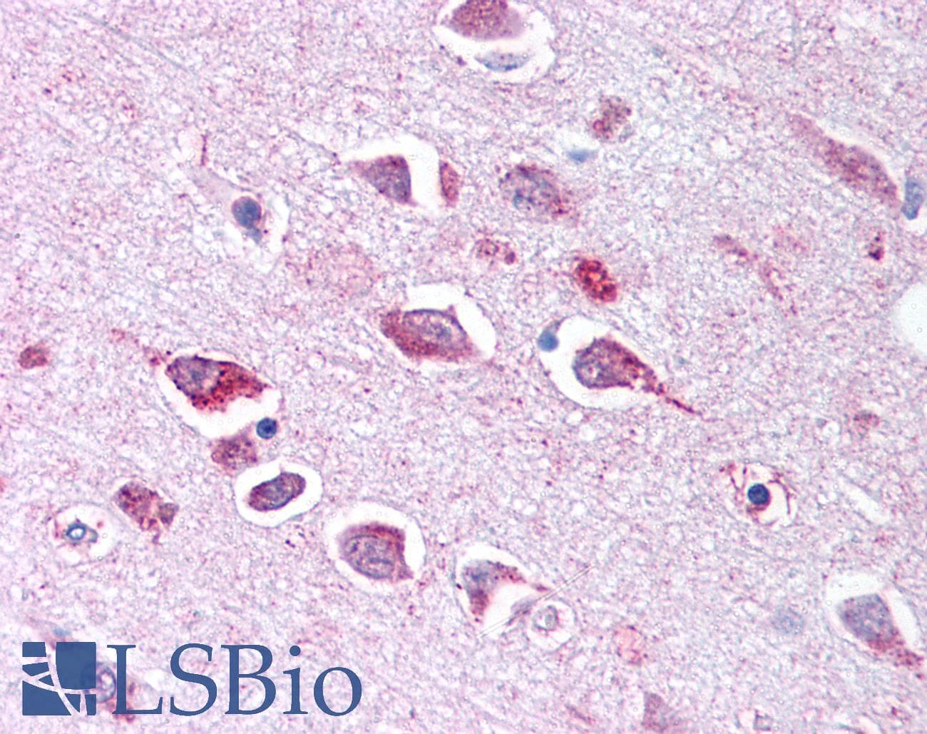 IHC-plus™ TLL2 Antibody (CUB 2 Domain)