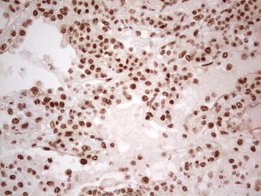 ERCC1 Antibody (clone OTI2B4, Carrier-free)