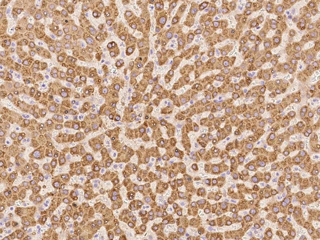Polyclonal Rabbit anti-Human H6PD / G6PDH Antibody (IHC, IF)