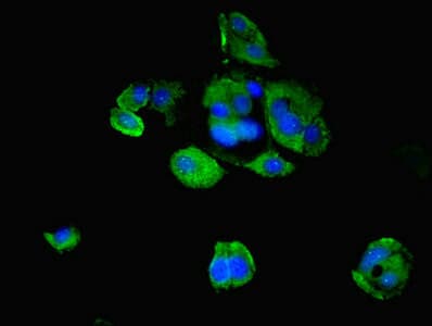 TRIM1 / MID2 Antibody