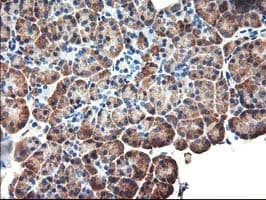EIF2B3 Antibody (clone OTI3H3)