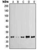 KRT19 / CK19 / Cytokeratin 19 Antibody (C-Terminus)