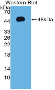 Adiponectin Antibody (aa111-247, Biotin)