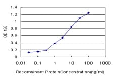 IHC-plus™ SGK1 / SGK Antibody (clone 3G8)