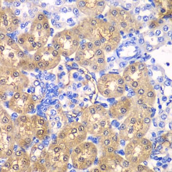 Polyclonal Rabbit anti-Human HPD Antibody (IHC, IF, WB)