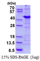 Human PPP1R8 / Rnase E Protein (Recombinant His)