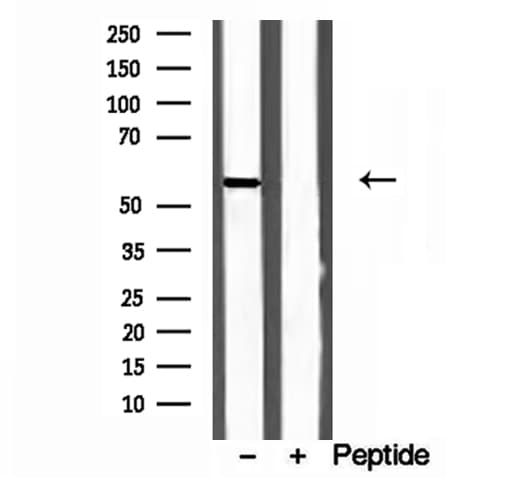 CYP26B1 Antibody