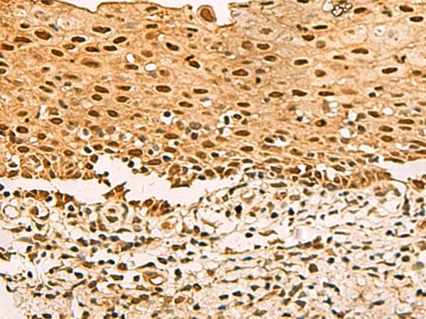 UBLCP1 Antibody