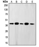 FEN1 Antibody (Internal)