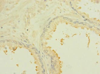 ROBO2 Antibody