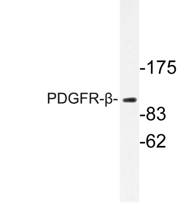 PDGFRB / PDGFR Beta Antibody (Lys745)