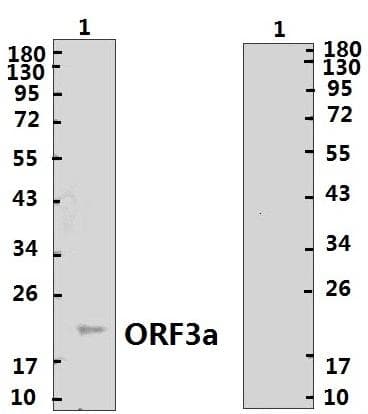 Coronavirus SARS-CoV-2 ORF3a Protein (Recombinant His)