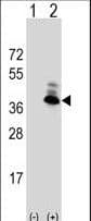 ASPA Antibody (aa82-110)