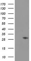 CDKN3 / KAP Antibody (clone OTI2A5)