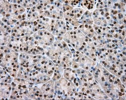 DAPK2 / DAP Kinase 2 Antibody (clone OTI1C8)