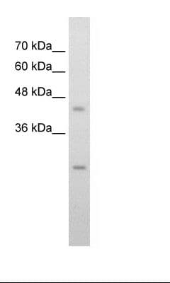 SLC48A1 / HRG1 Antibody (C-Terminus)