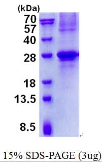 Human GCET2 / HGAL Protein (Recombinant His)
