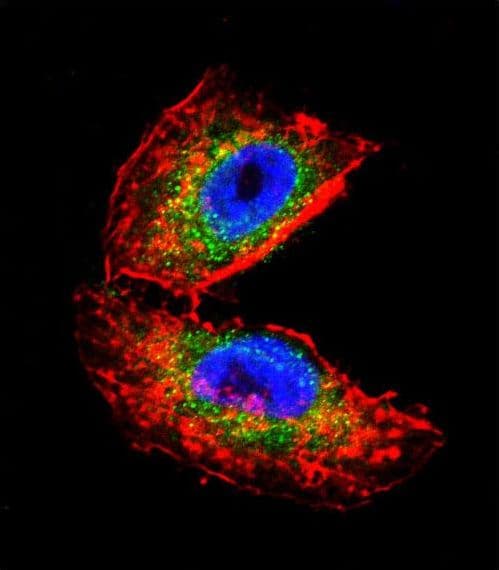Polyclonal Rabbit anti-Human ACHE / Acetylcholinesterase Antibody (aa147-175, IHC, IF, WB)