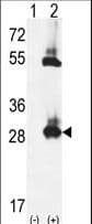 Polyclonal Rabbit anti-Human TPK1 Antibody (aa34-61, IHC, WB)