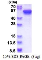 Human KRT16 / CK16 / Cytokeratin 16 Protein (Recombinant His)