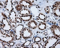 Monoclonal Mouse anti-Human MCL1 / MCL 1 Antibody (clone OTI4B7, IHC, IF, WB)
