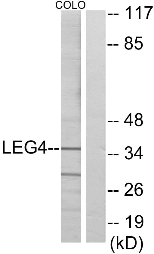 GAL4 / Galectin 4 Antibody (aa61-110)