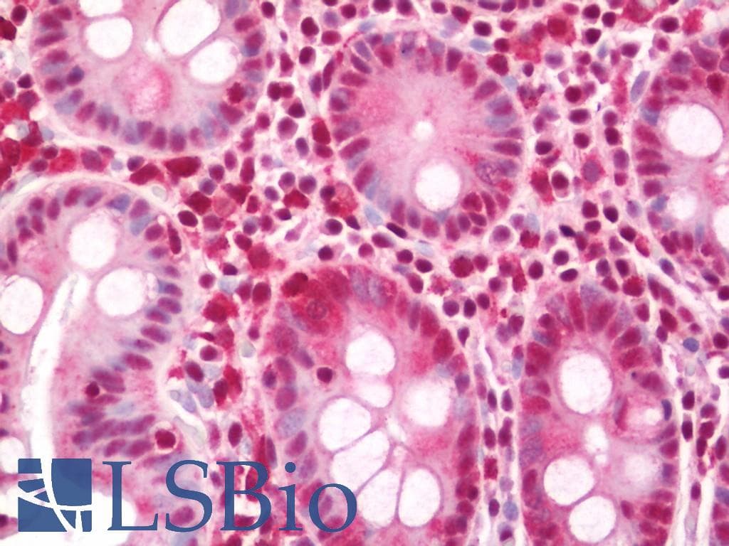 IHC-plus™ PHF8 Antibody (aa650-700)