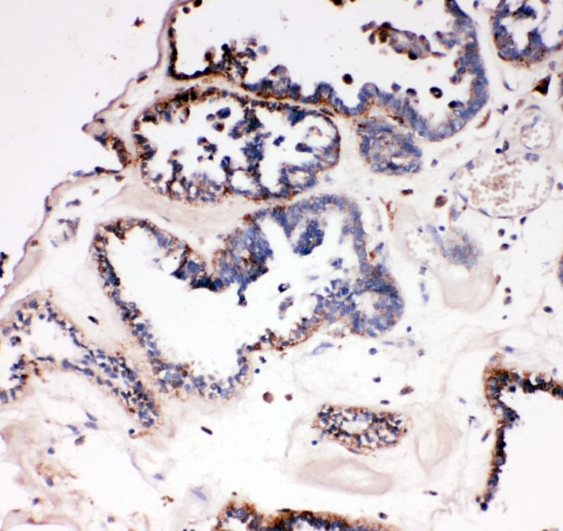DDX4 / VASA Antibody (aa253-272)