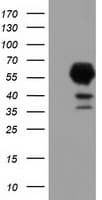 EPHX2 / Epoxide Hydrolase 2 Antibody (clone OTI1A6, Carrier-free)