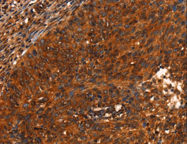 Polyclonal Rabbit anti-Human PRKD1 / PKC Mu Antibody (IHC, WB)