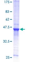 Human RAB31 Protein (Recombinant GST)
