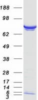 Human PPM1G Protein (Recombinant Myc-DDK (Flag))