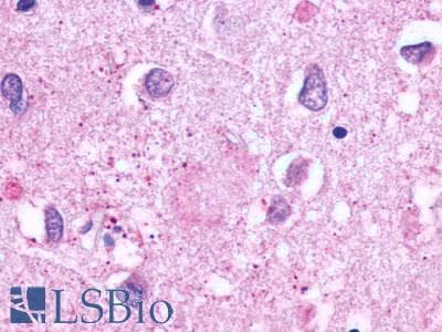 PathPlus™ ADGRE3 / EMR3 Antibody (N-Terminus)