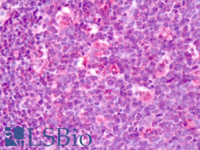 IHC-plus™ ADGRL3 / LPHN3 Antibody (C-Terminus)