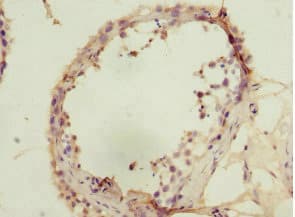 Polyclonal Rabbit anti-Human SIVA1 / SIVA Antibody (IHC)