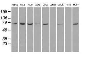 IHC-plus™ Heat Shock Protein 70 / HSPA1A Antibody (clone 5F3)